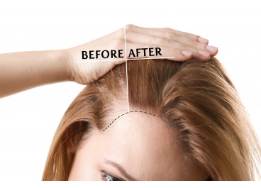 How to stop hair loss and speed up its growth?