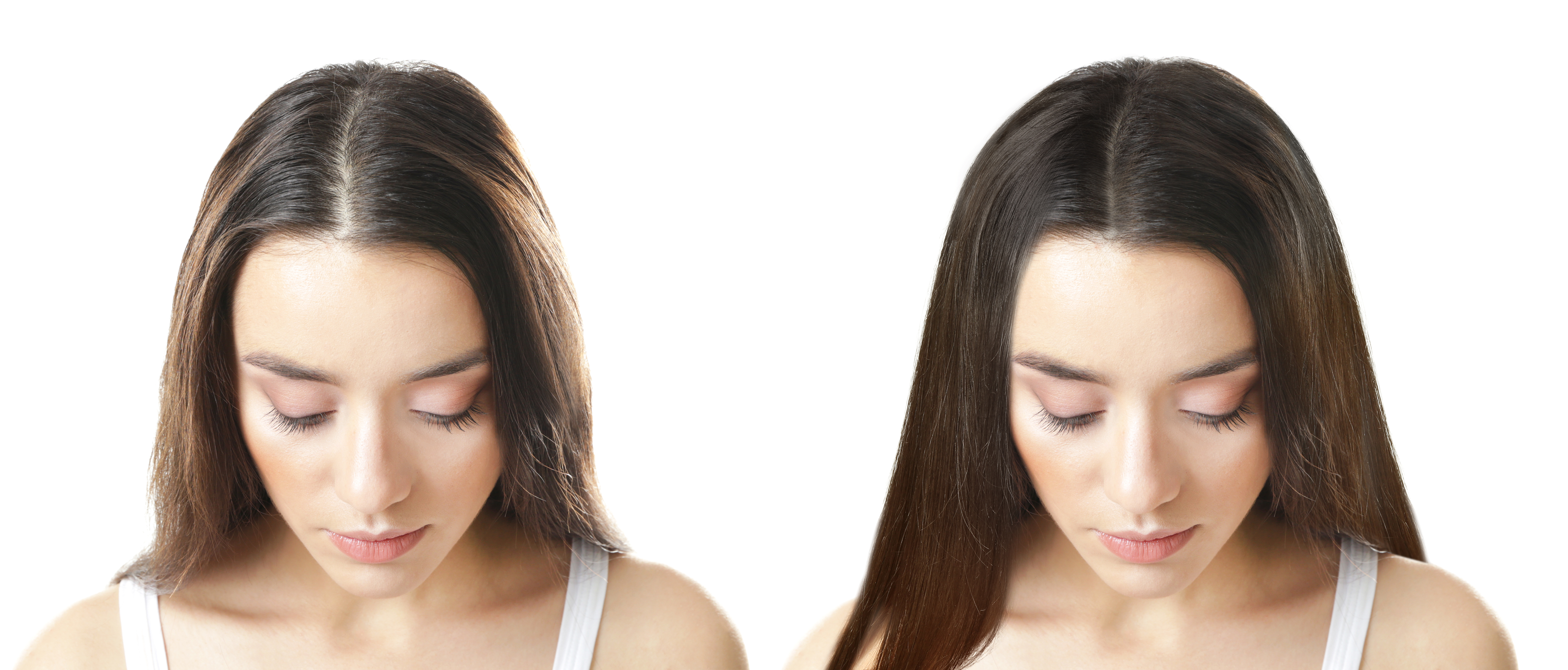 Как остановить выпадение волос и ускорить его рост? - Irene Bukur